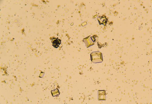Cómo identificar síntomas
