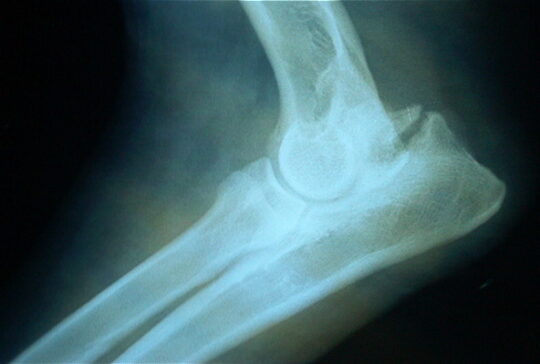 La espondilosis en perros: una condici&oacute;n degenerativa que debes conocer